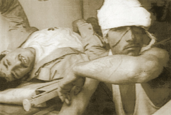 Dos iraquíes heridos con armas químicas durante la Guerra del Golfo y capturados cerca de la frontera con Kuwait. Fotos: Archivo Excélsior
