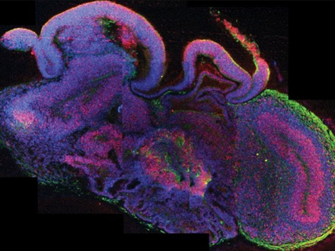 Desarrollan microcerebros humanos a partir de células madre