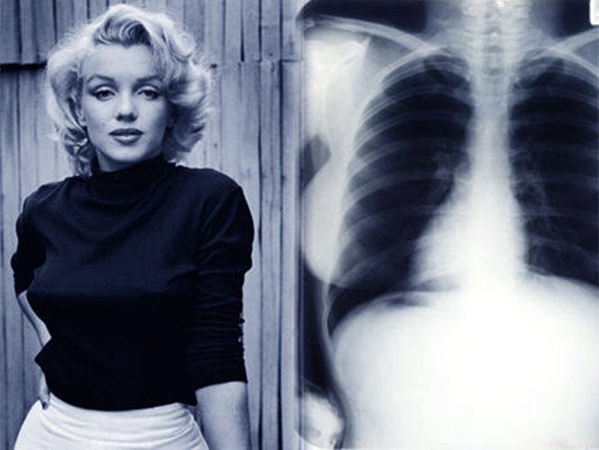 Subastan radiografías de una cirugía estética de Marilyn Monroe | Excélsior